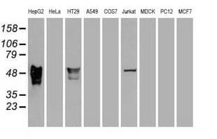 IHC-plus™ Monoclonal Mouse anti-Human SERPINA1 / Alpha 1 Antitrypsin Antibody (clone 1C2, IHC, IF, WB)