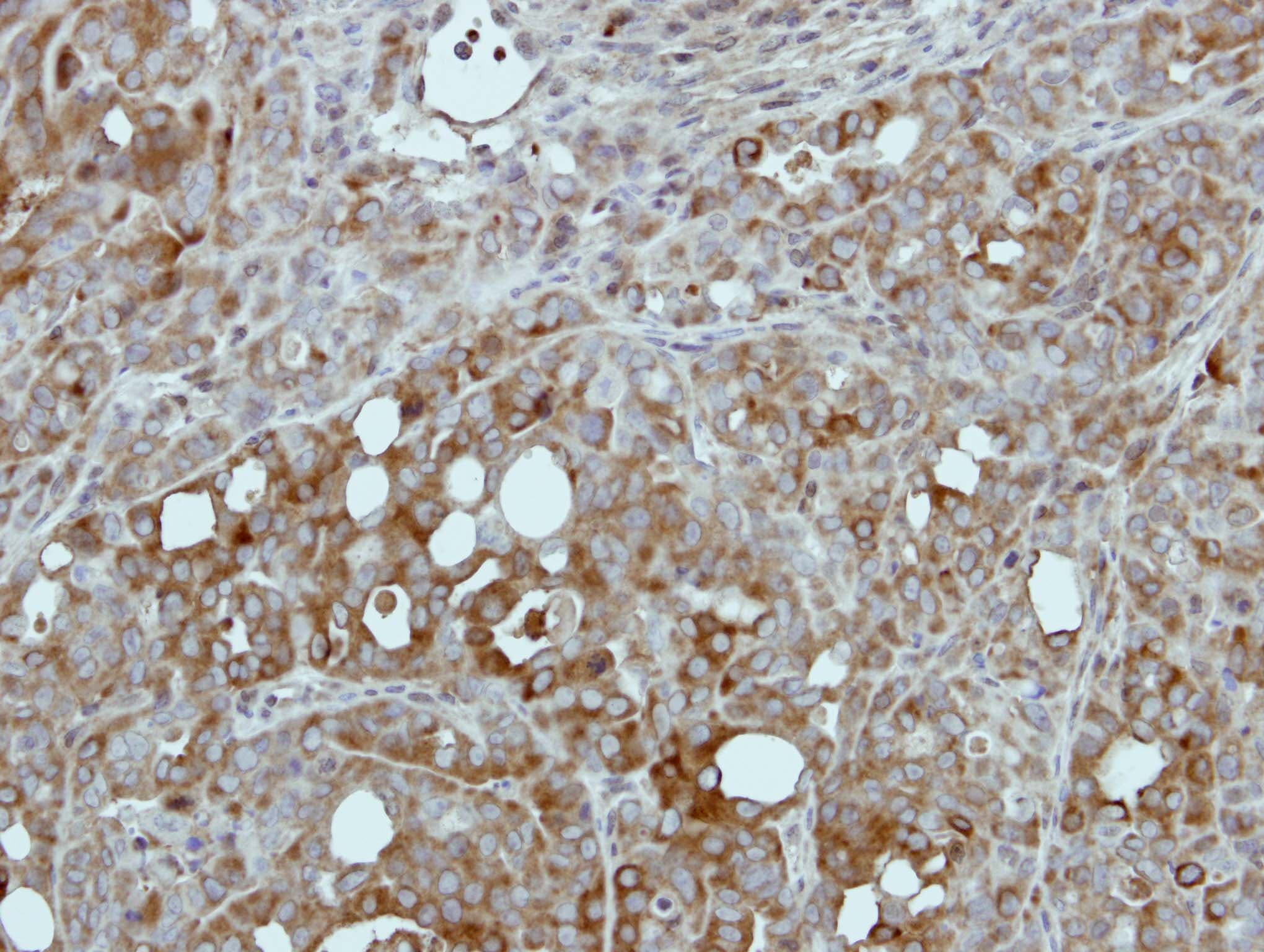 PKLR Antibody (aa1-260)