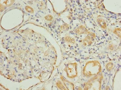 Polyclonal Rabbit anti-Human RNF31 Antibody (IHC)