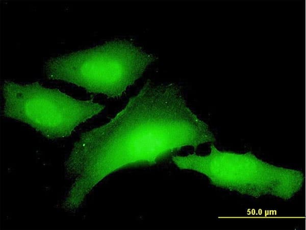 HnRNP-E1 / PCBP1 Antibody (clone 1G2)