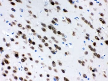 ELAVL4 / HuD Antibody
