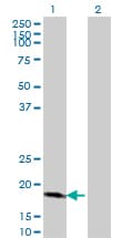 CDKN2D / p19 INK4d Antibody (clone 2E10)