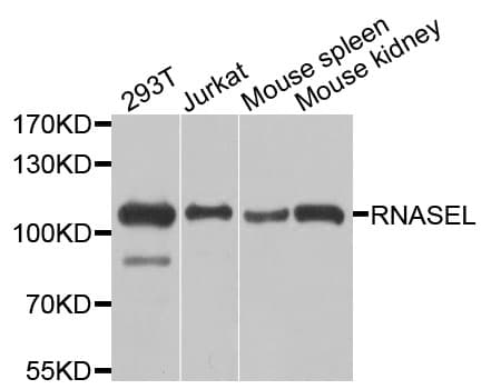 RNASEL / RNase L Antibody