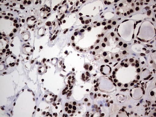 HNRNPL / hnRNP L Antibody (aa270-502, clone OTI2E4)