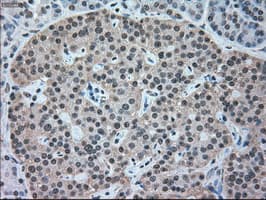 Monoclonal Mouse anti-Human NRBP1 / NRBP Antibody (clone OTI7E2, IHC, WB)