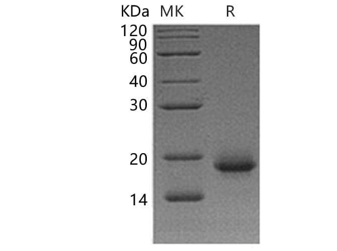 Human IL4 Protein (Recombinant)