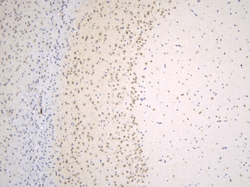 TAF12 Antibody