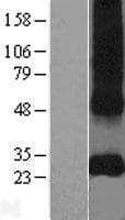 Human CD151 Protein (Over-Expression Lysate Myc-DDK (Flag))