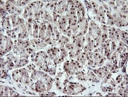 MYBPH Antibody (clone OTI3G1)