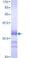 Human SOX12 Protein (Recombinant GST, N-terminus)