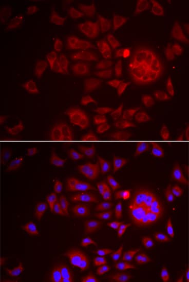 SPINT1 / HAI-1 Antibody
