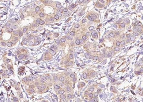 Polyclonal Rabbit anti-Human PTPN11 / SHP-2 / NS1 Antibody (phospho-Tyr542, IHC, IF, WB)