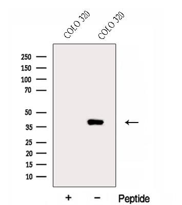 Polyclonal Rabbit anti-Human ERLIN1 / SPFH1 Antibody (WB)