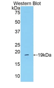 MASP2 / MASP-2 Antibody (aa280-433)