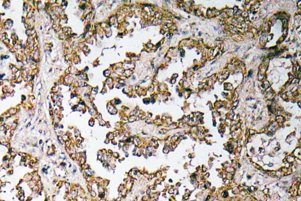 MSTN / GDF8 / Myostatin Antibody (Leu38)
