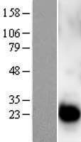 CETN1 Protein (Over-Expression Lysate Myc-DDK (Flag))