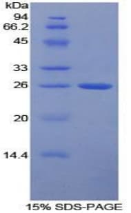 Human FCGR1A / CD64 Protein (Recombinant His-T7)
