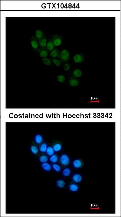 Polyclonal Rabbit anti-Human FOXB1 Antibody (IF, WB)