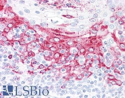 Polyclonal Rabbit anti-Human KLK8 / Kallikrein 8 Antibody (aa29-260, IHC, WB)
