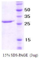 Human NCR1 / NKP46 Protein (Recombinant)