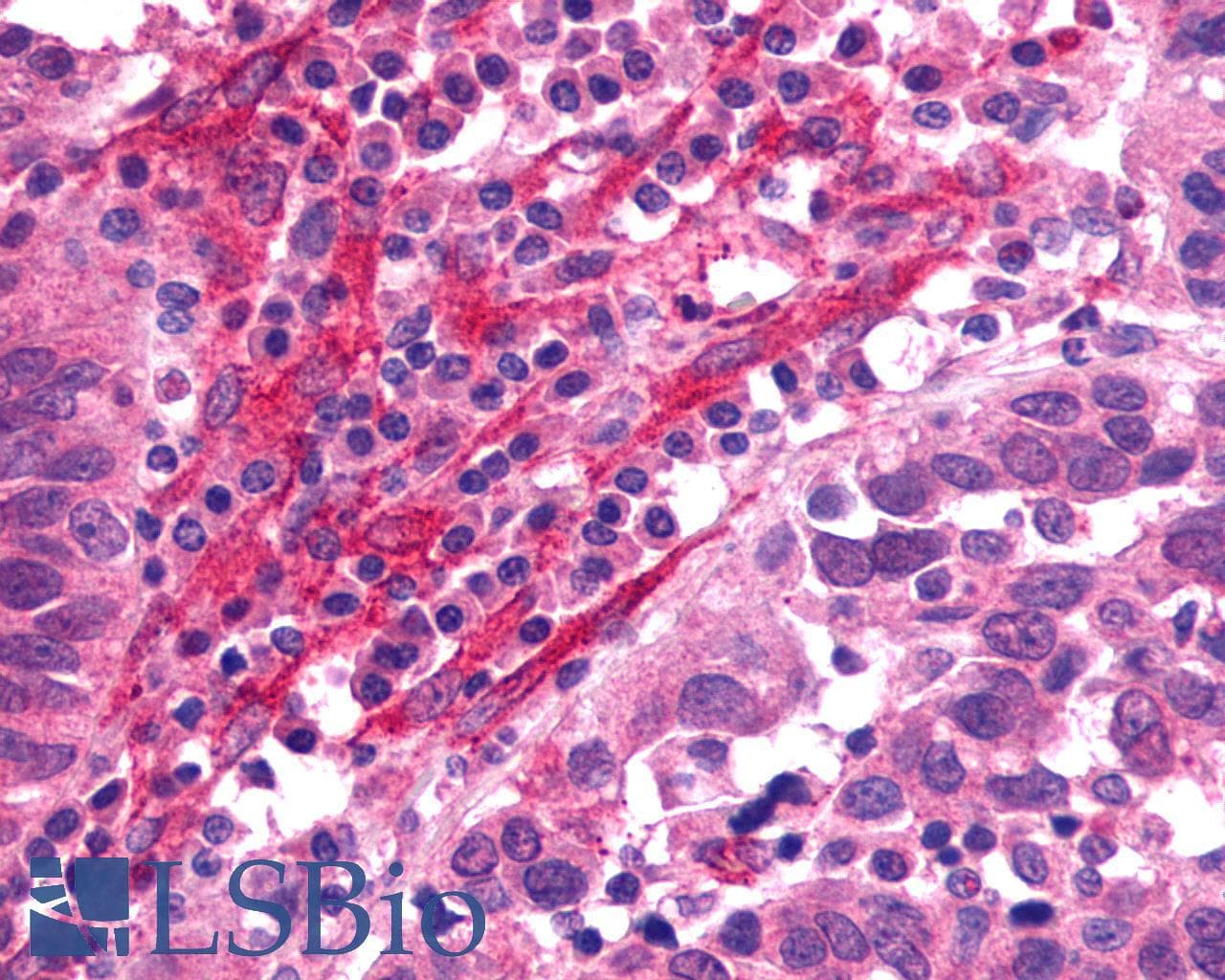 PathPlus™ Polyclonal Rabbit anti-Human SSTR1 Antibody (C-Terminus, IHC)