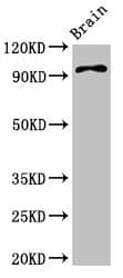 ABR Antibody