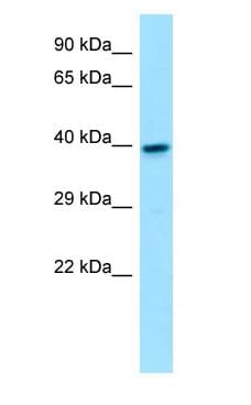 Polyclonal Rabbit anti-Human GNA11 Antibody (aa61-110, WB)