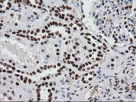 ZSCAN18 / ZNF447 Antibody (clone OTI1F10)