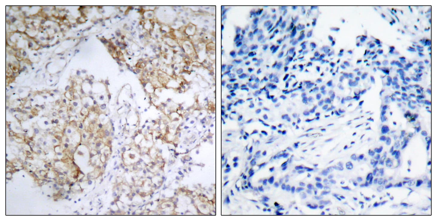 IGF1R / IGF1 Receptor Antibody (phospho-Tyr1161)