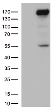 XDH / Xanthine Oxidase Antibody (aa1-280, clone OTI1C10)