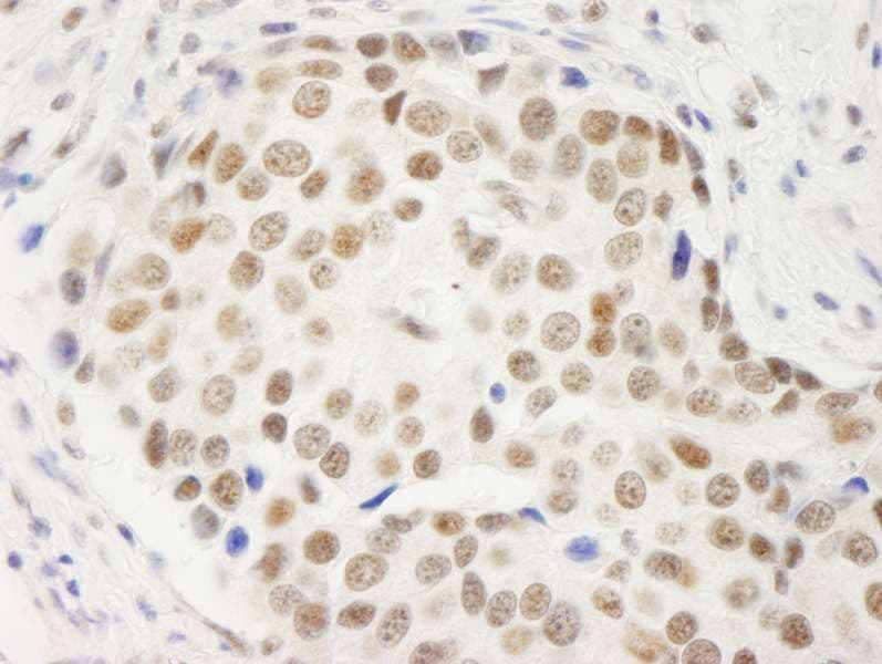 Polyclonal Rabbit anti-Human SYMPK / Symplekin Antibody (aa1224-1274, IHC, WB)