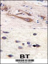 VILIP / VSNL1 Antibody (aa123-150)