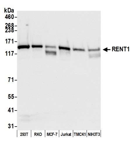 IHC-plus™ Polyclonal Goat anti-Human RENT1 / UPF1 Antibody (aa1075-C-term, IHC, WB)