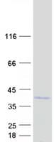 Human ZNF691 Protein (Recombinant Myc-DDK (Flag))