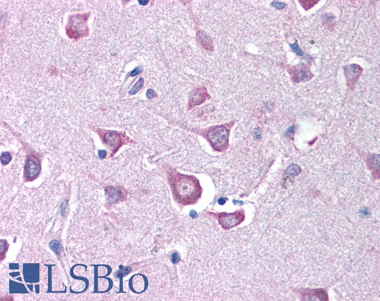 RPE65 Antibody (clone 401.8B11.3D9, Biotin)