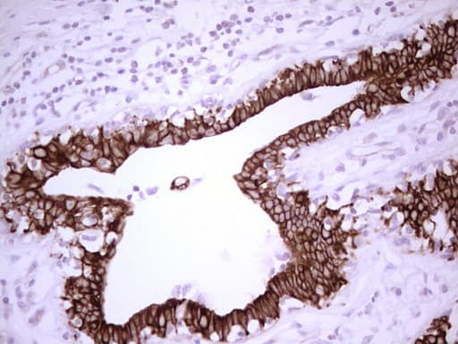 ABCB1 / MDR1 / P Glycoprotein Antibody (aa995-1280, clone OTI10H3, Carrier-free)