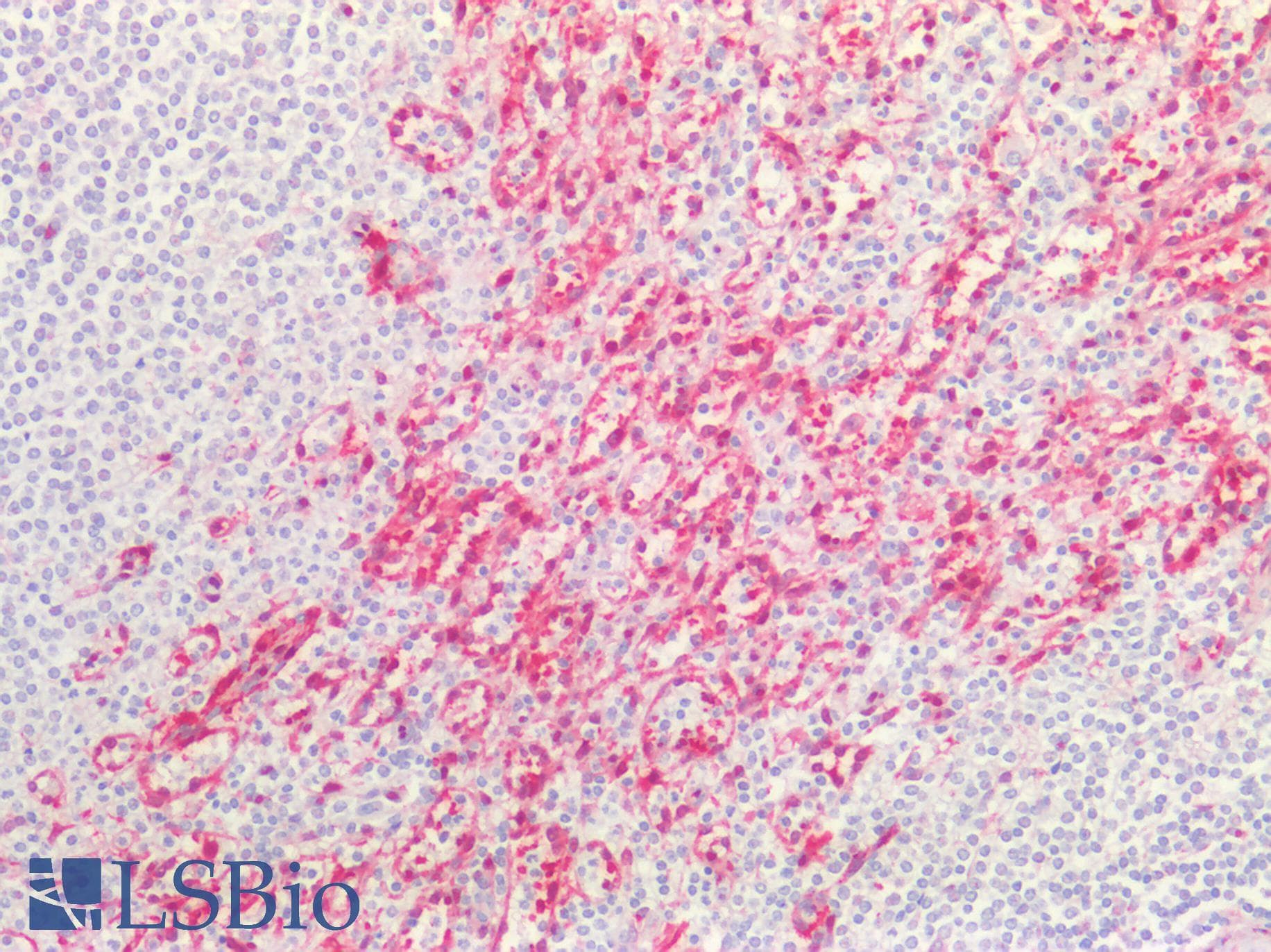 PathPlus™ ALDH1A1 / ALDH1 Antibody