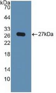 KPNA2 / Importin Alpha 1 Antibody (aa157-412)