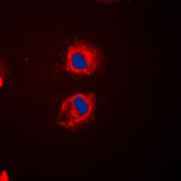 EPS8L2 Antibody (N-Terminus)