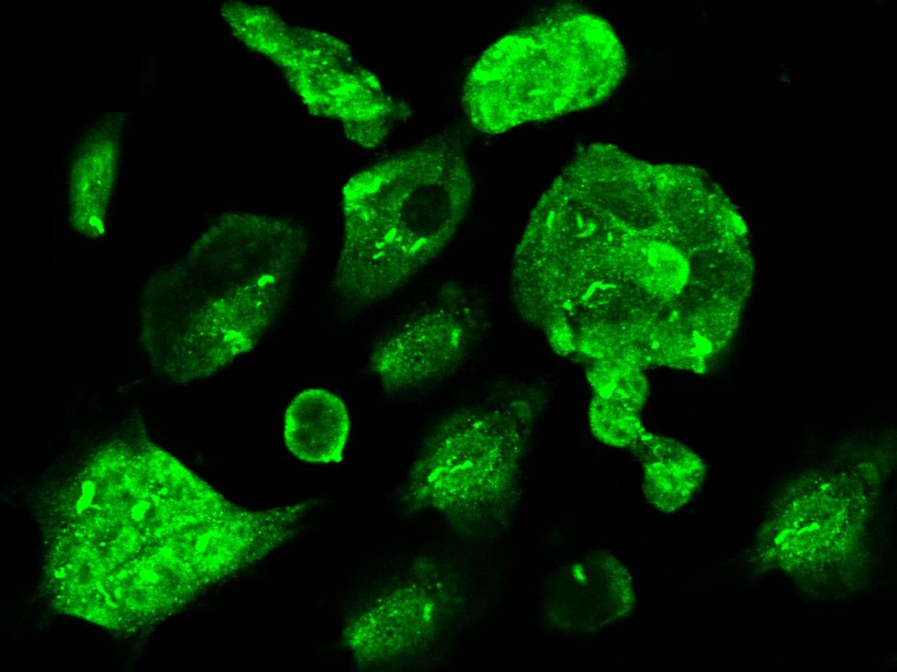 Polyclonal Rabbit anti-Human CBFB Antibody (Preservative Free, IF, WB)