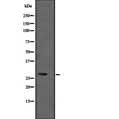 UBE2R2 Antibody