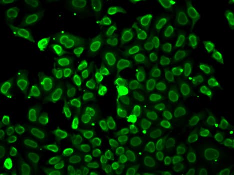 LMNA / Lamin A+C Antibody