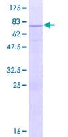 Human MAT2A Protein (Recombinant GST)