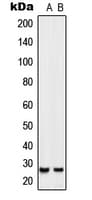 SIX6 Antibody (Internal)