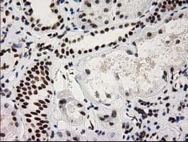 CTDSP1 / SCP1 Antibody (clone OTI1G1)