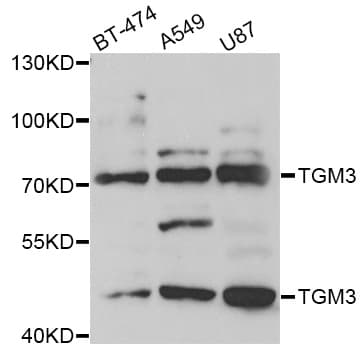 Polyclonal Rabbit anti-Human TGM3 / Transglutaminase 3 Antibody (IF, WB)
