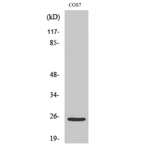 ITGA7 / Integrin Alpha 7 Antibody (910-990 aa, C-terminal)