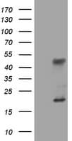 LCX / TET1 Antibody (aa1-305, clone OTI7E2)