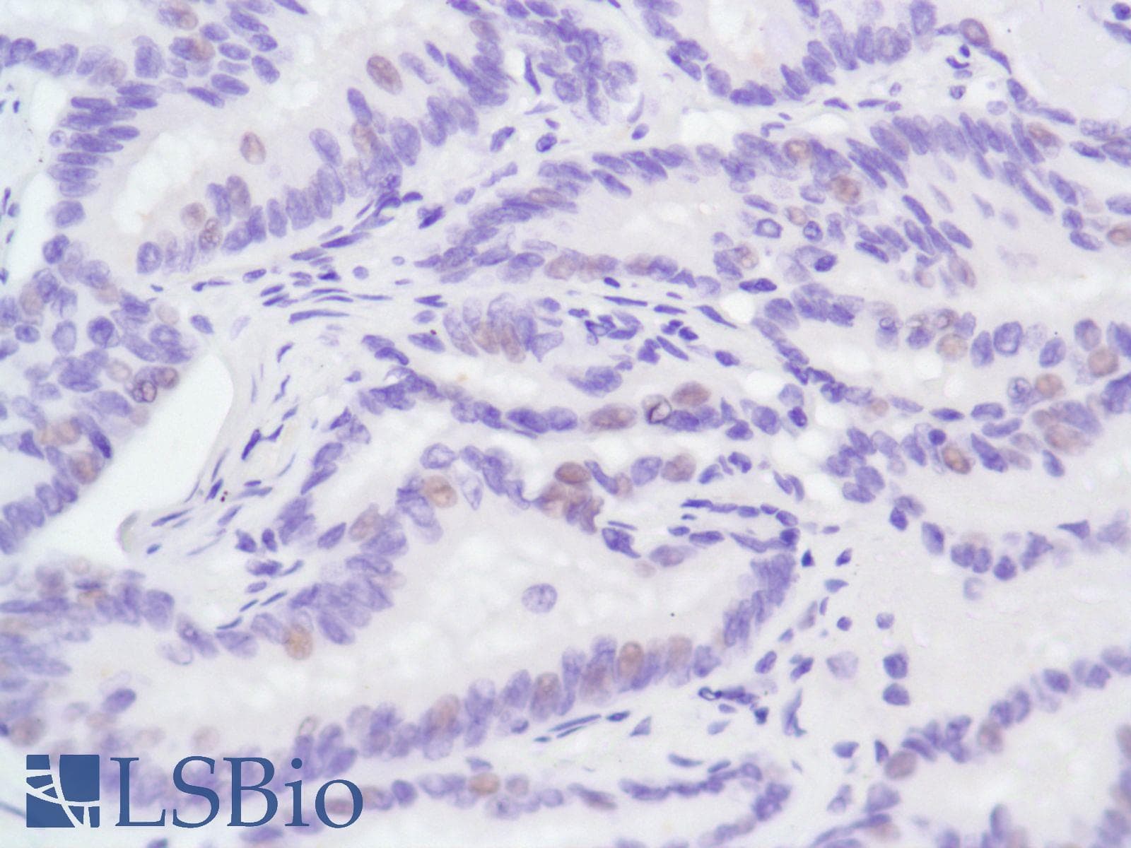 Monoclonal Rabbit anti-Human AR / Androgen Receptor Antibody (clone SP107, N-Terminus, IHC)