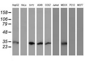 IF3mt / MTIF3 Antibody (aa56-278, clone OTI1E8)